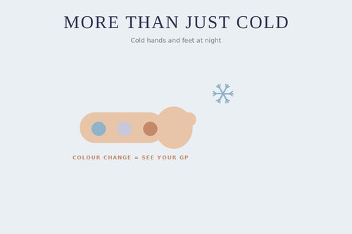 Illustration of a hand with colour-change zones — cold hands and feet at night, more than just cold